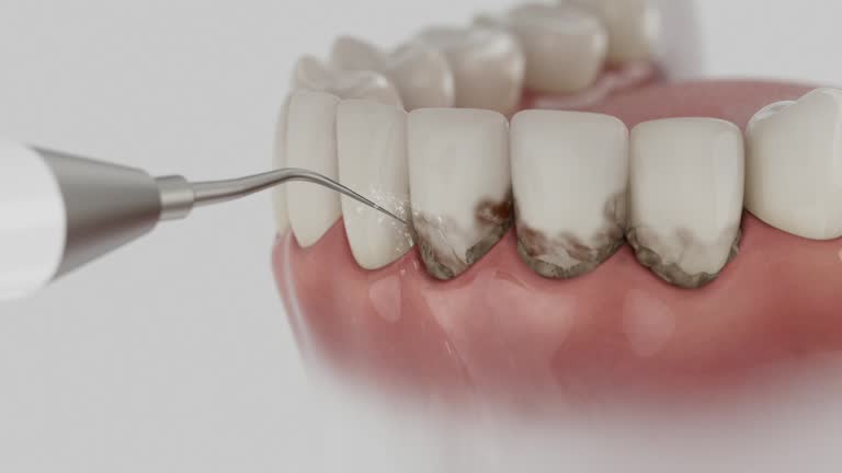 Reliable Tooth Extraction contractor in Hazlehurst, GA by Smile Center Dentistry